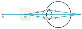 cbse-class-10-science-sqp-solution-2025-q31